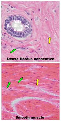 dense connective vs. smooth muscle photos